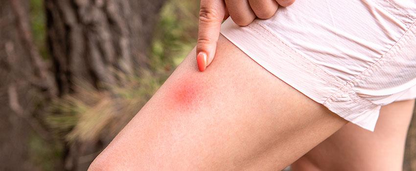 Tick Activity on the Rise in Florida