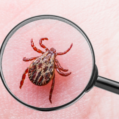 Columbia South Carolina Lyme Disease Doctor: Get Expert Help Today