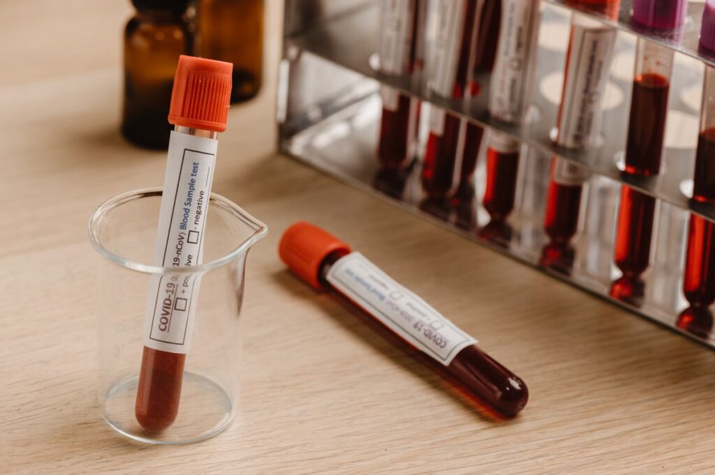 Why Lyme Disease Tests Come Back Negative When You’re Still Sick