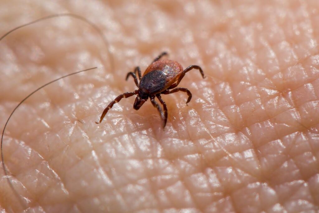 Close-up of a tick attached to human skin